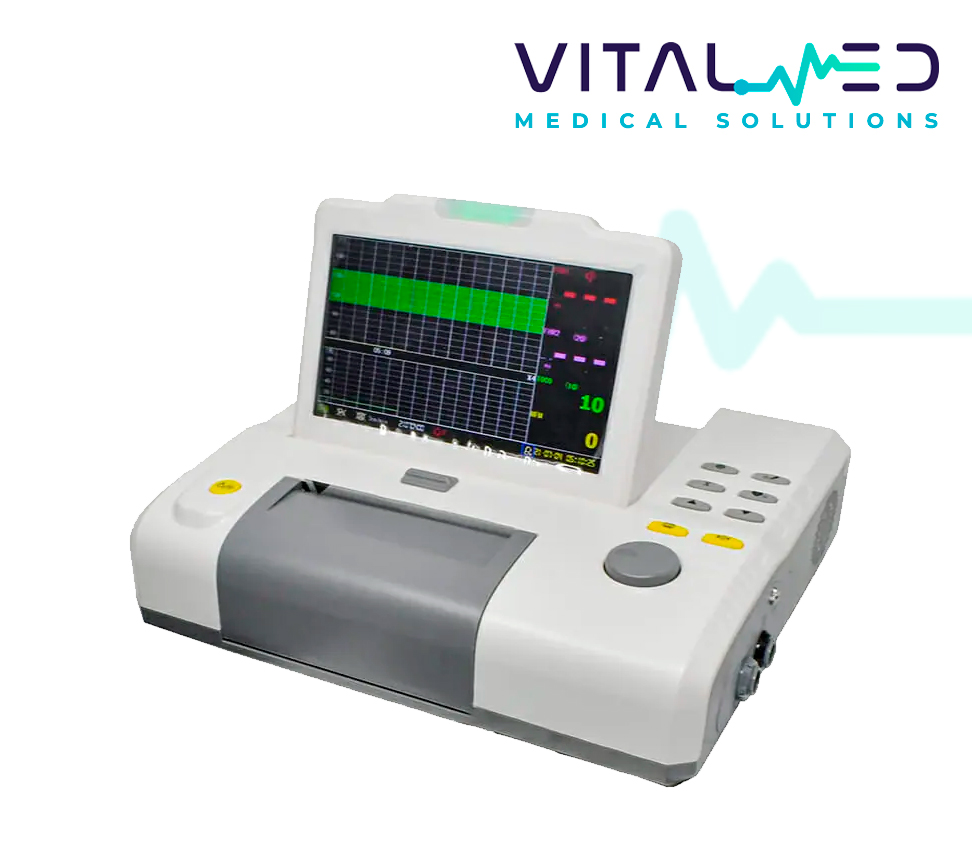 Monitor Fetal Graphic Color