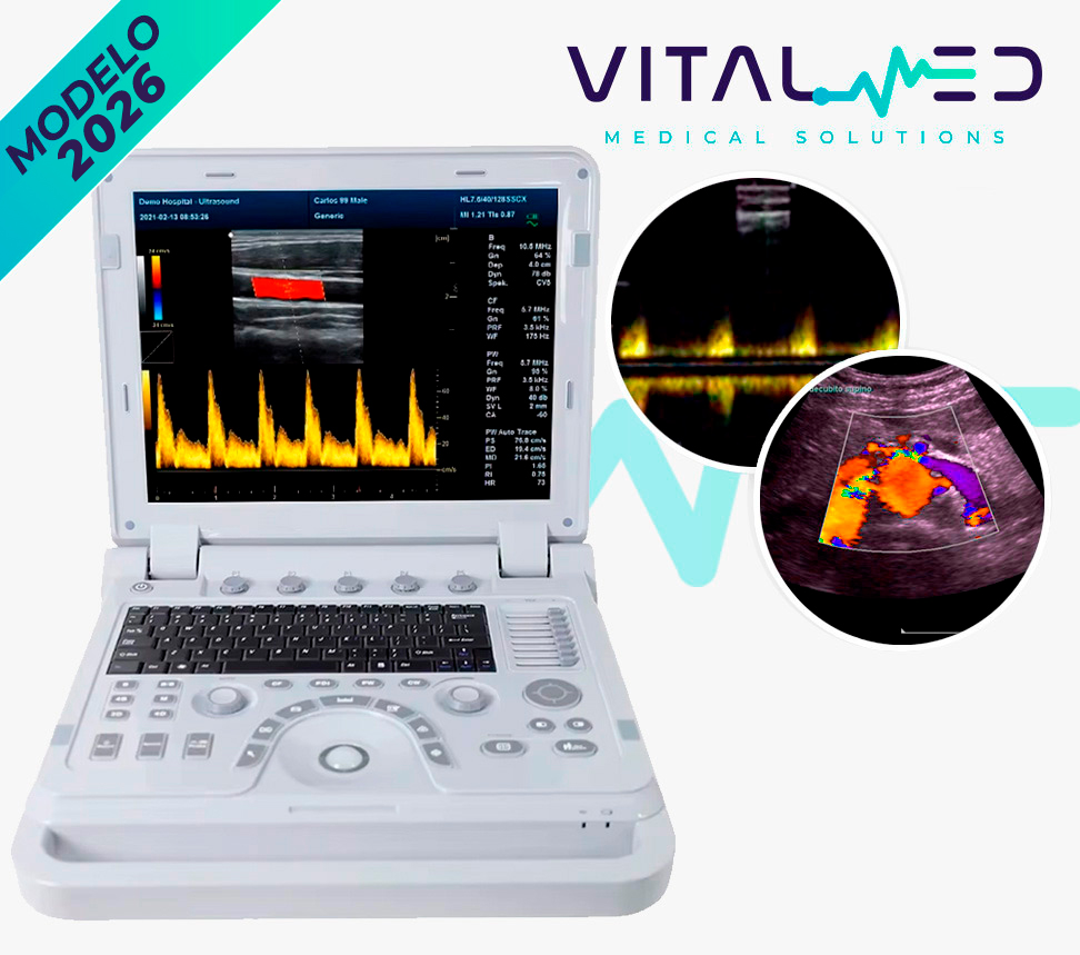 Ultrasonido Luminus TCM9